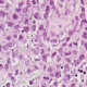 Grup-Hematoligia-web